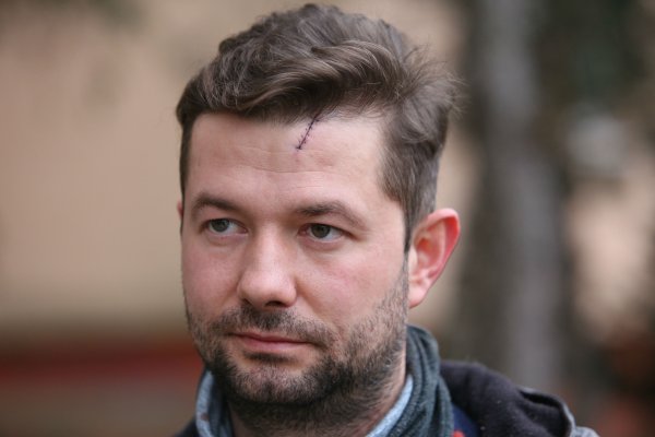 Futbalista Weiss bol pri bitke, hudobníkovi rozrazili čelo