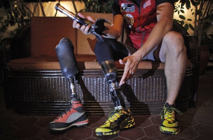 Podľa typu amputácie začínajú protézy dolných končatín od 1000 Eur. Najdrahšie stoja aj 17-krát toľko. (AP Photo/Niranjan Shrestha)