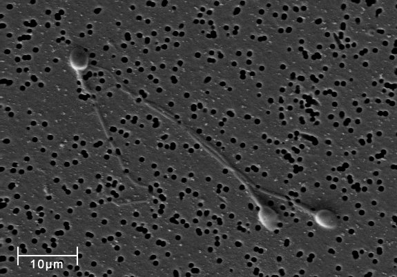 SEM (Scanning Electron Micrograph) fotografia ľudských spermií. Ilustračné foto - Wikimedia Commons