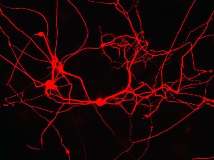 Takto vyzerajú novovytvorené neuróny z buniek pokožky. Tentoraz vedci nepoužili genetiku, ale chémiu. Foto – TASR/Thomas Vierbuchen/Marius Wernig