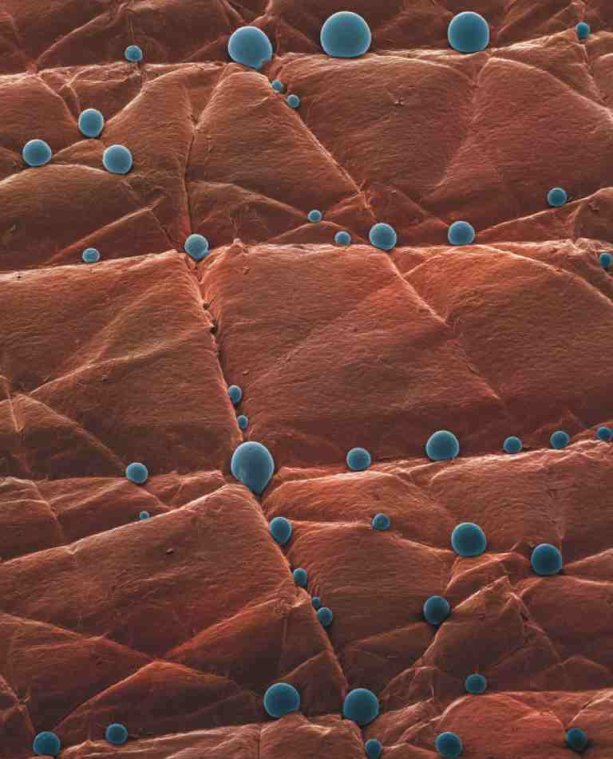 Zdroj: http://www.spot-on-micro.eps.hw.ac.uk/sites/default/files/submissions-2015-public/Human%20Skin%20with%20globules.jpg