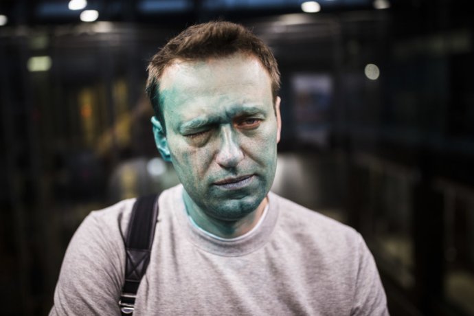 Šrek-2, tentoraz s jedným okom. Tak sa po útoku opísal Navaľnyj na Twitteri. Foto – AP