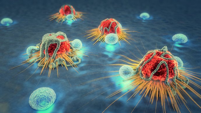 Rakovinové bunky a lymfocyty. Foto - Fotolia