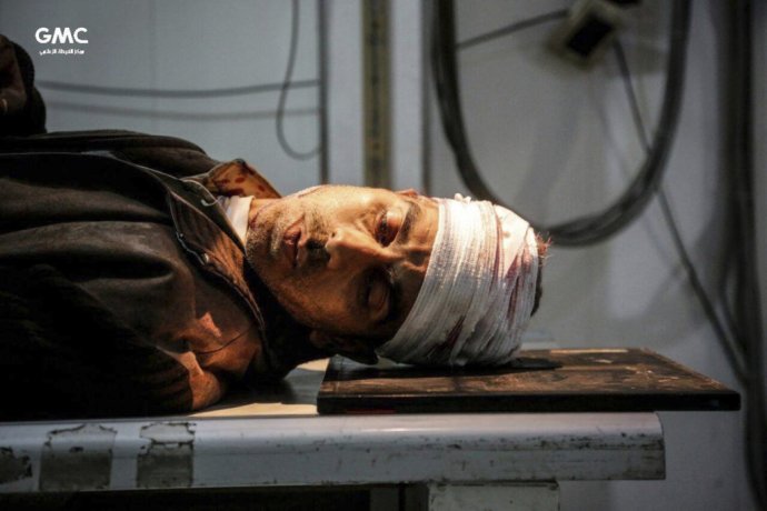 Zranený Sýrčan po útoku vládnych jednotiek v Ghúte. Foto – AP