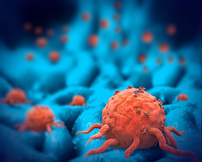Rakovinové bunky. Ilustračné foto – Fotolia