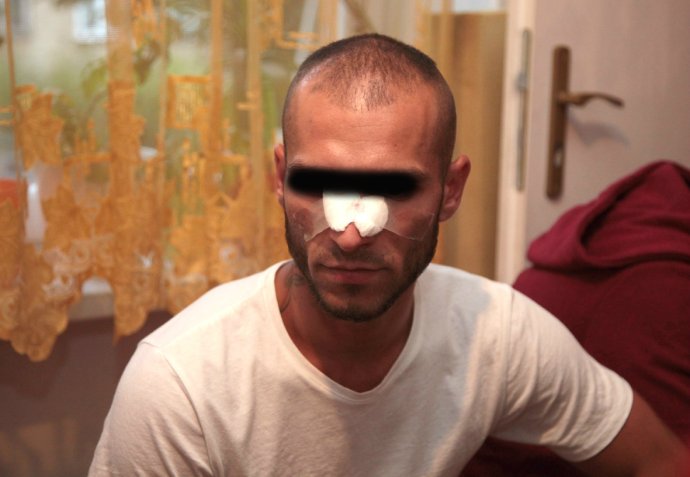 Jeden zo zbitých v Žiline. Foto – Ľubo Bechný