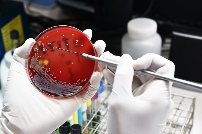 Baktérie sú čoraz odolnejšie, vedci varujú pred antibiotickou rezistenciou. Foto - Fotolia