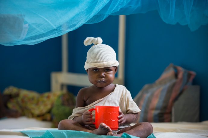 Podvýživa je v DR Kongo vážny problém. Foto - Lekári bez hraníc/Vincenzo Livieri