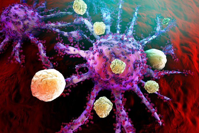 T-bunky útočia na rastúce rakovinové bunky. Foto – Adobe Stock