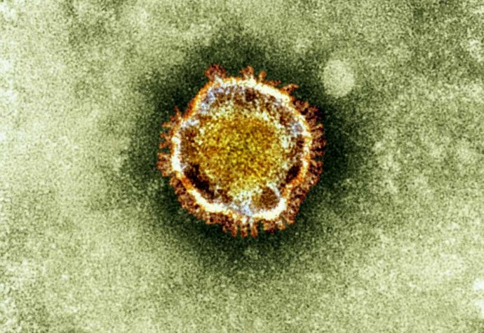 Na snímke nový typ koronavírusu, ktorý pochádza z rovnakej skupiny ako vírus SARS. Foto - TASR/AP