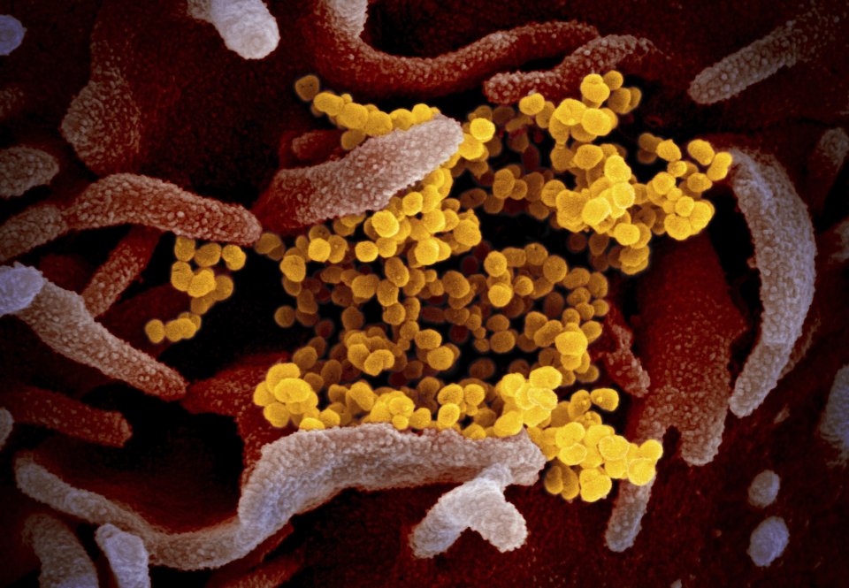 Nový koronavírus (žltou farbou). Foto – TASR/AP