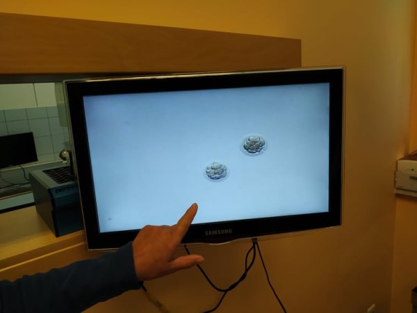 Keď Anna Záborská hovorí o&nbsp;umelom oplodnení, moja žena plače