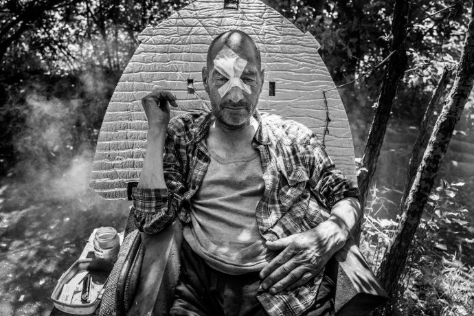 Keď sa Miki v lete učil chodiť na obhorených nohách, občas spadol na tvár. Navyše ho zmlátil kamarát. Foto – Kevin V. Ton/Verum Photo 2020