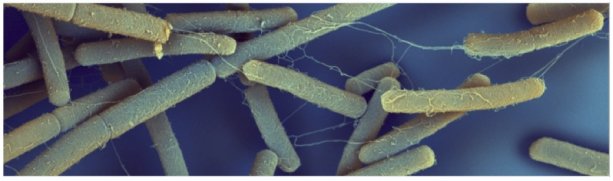 Snímka zo skenovacej elektrónovej mikroskopie buniek Bacillus subtilis, ktoré sú akoby poprepájané nanotrubicami (Zdroj: O. Benada, Mikrobiologický ústav, Akademie věd, ČR).