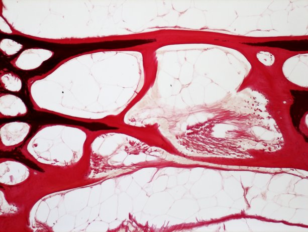 Špongiózna kosť stavca lososa atlantického kŕmeného nízkym obsahom fosforu. Čierna farba znázorňuje mineralizovanú kosť a červená znázorňuje kosť, ktorá ostala nemineralizovaná.