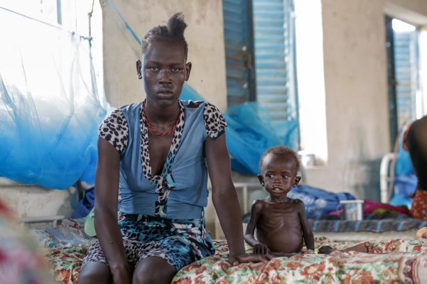 © UNICEF/UN0475214/Obel: Mladá mamička kráčala 2 dni do Pobei. V Gumuruku, odkiaľ odišla, boli nepokoje. Nemali jedlo ani vodu a ich domy vypálili. Jej 17 mesačná dcérka mala hnačky a kašeľ. Vážila 4,7 kg, keď ich prijali v centre na liečbu podvýživy.