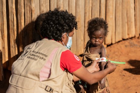 A humanitarian worker measures the circumference of the hand of a malnourished child from southern Madagascar.  Photo - WFP / Tsiory Andriantsoarana