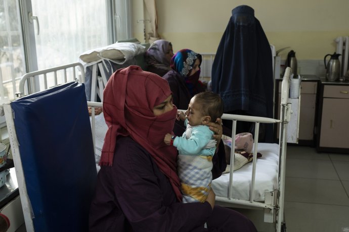 Žena drží svojho podvyživeného chlapca liečeného v Ataturkovej národnej detskej nemocnici v Kábule. Foto - TASR/AP