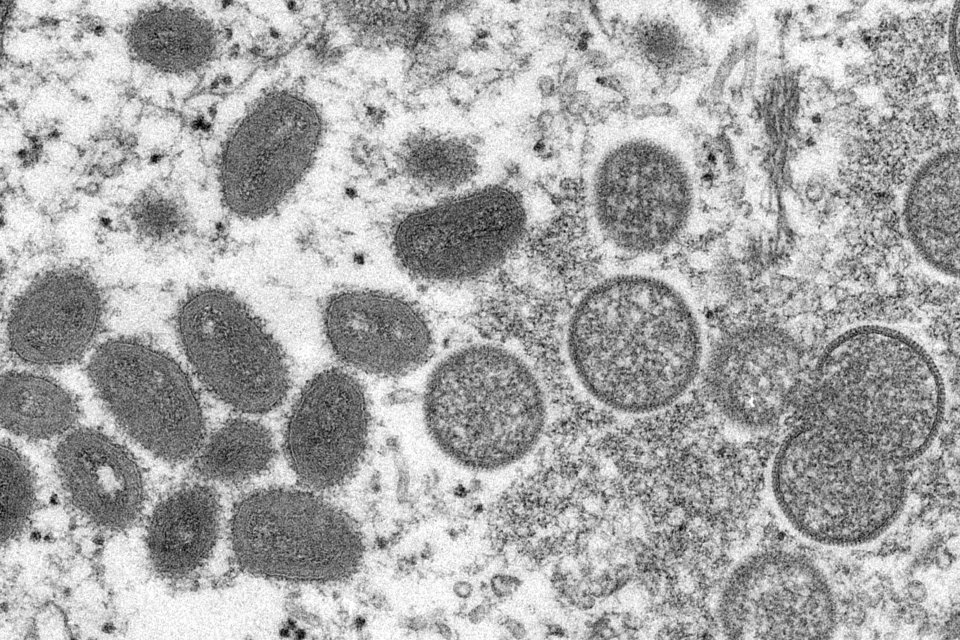 A majomhimlő vírusa egy 2003-as elektronmikroszkóp-felvételen. Forrás - TASR/AP