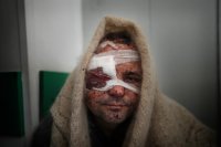 Zranený Serhij z Mariupola. Foto - Jevhen Maloletka, World Press Photo