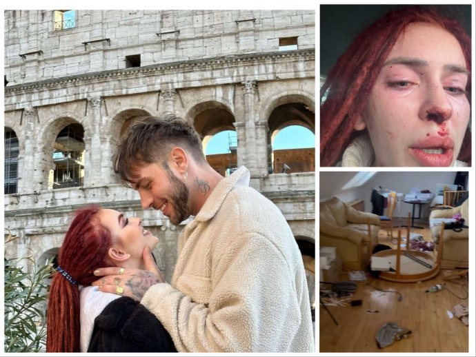 Influencerka Ráchel Karnižová s Tomym Kottym často prezentovali svoju lásku. Po útoku zverejnila svoju zranenú tvár aj zdemolovaný byt. Foto - Instagram