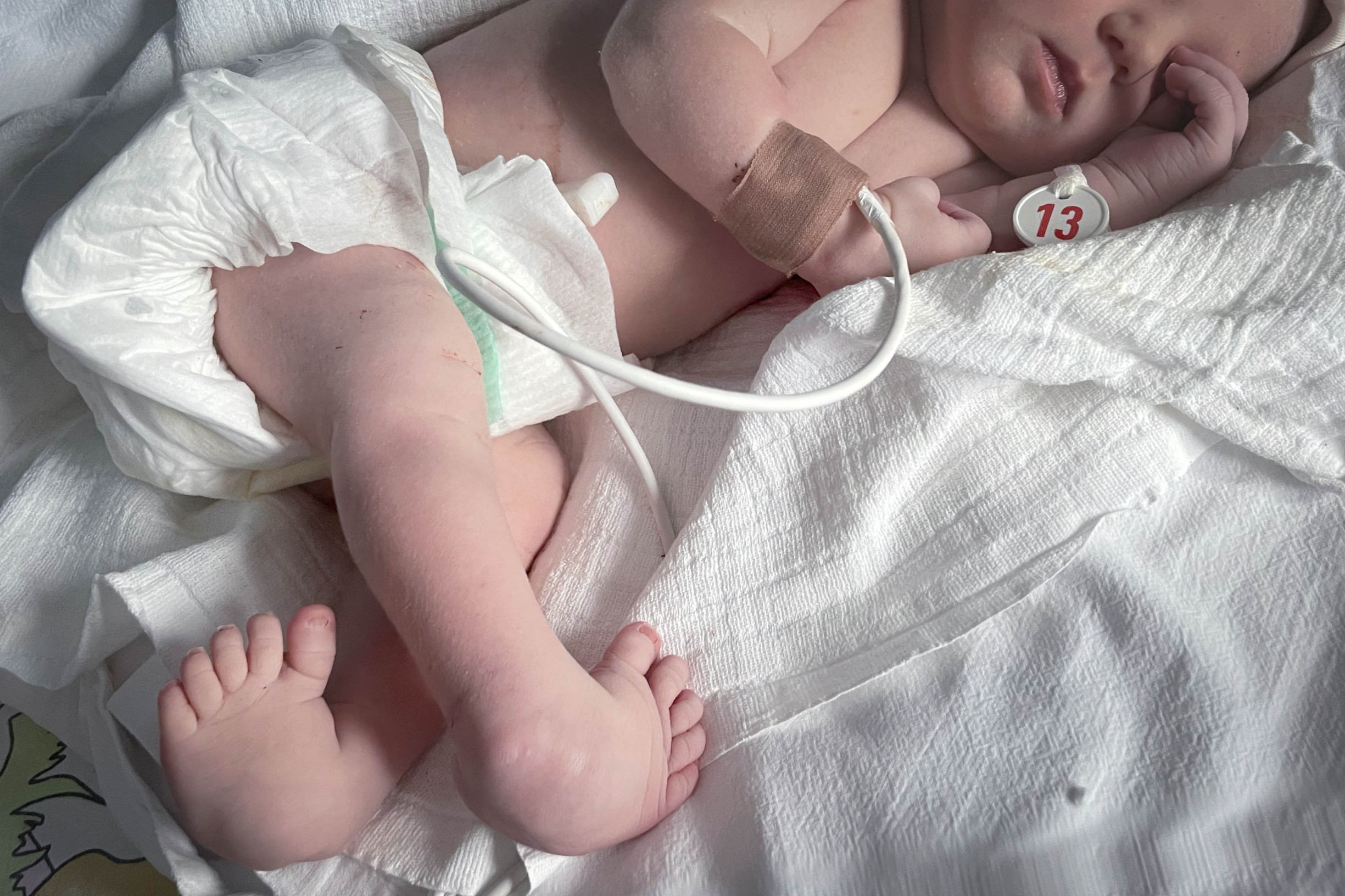 Za ortopedickú liečbu platia tisíce. Prečo slovenskí rodičia vozia deti na rakúske a&nbsp;české kliniky