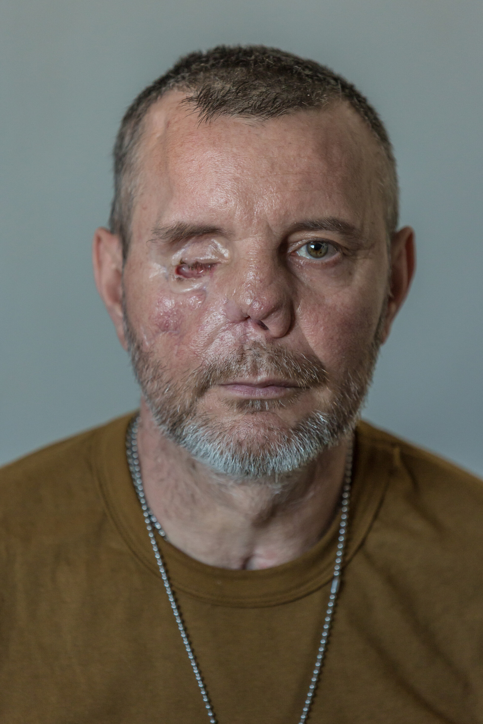 Zobraziť väčšie rozlíšenie