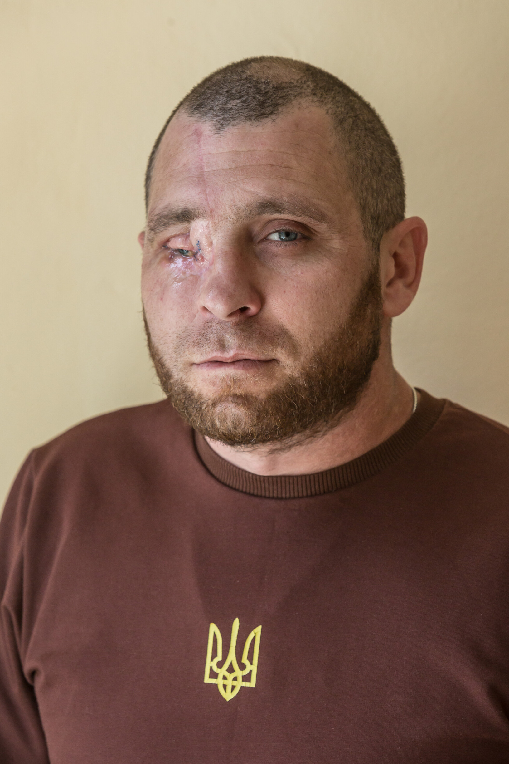 Zobraziť väčšie rozlíšenie