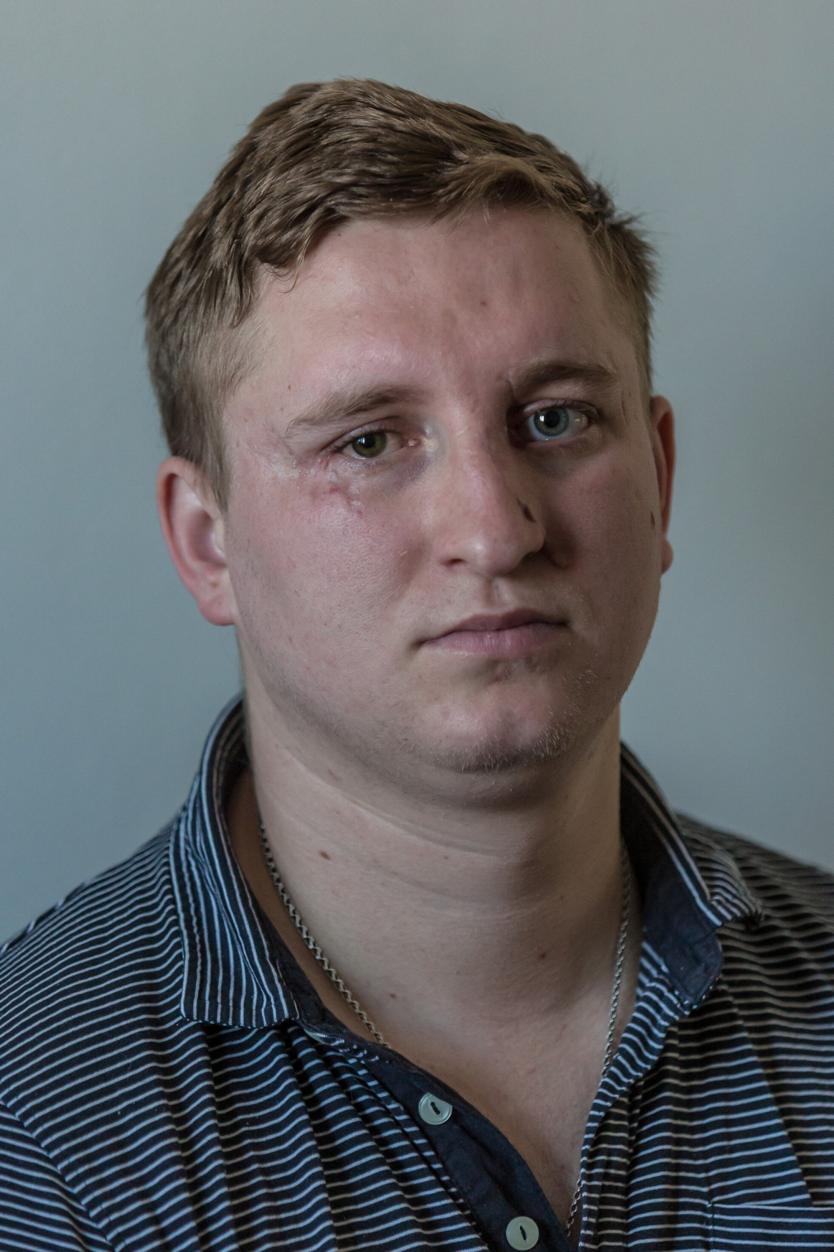 Zobraziť väčšie rozlíšenie