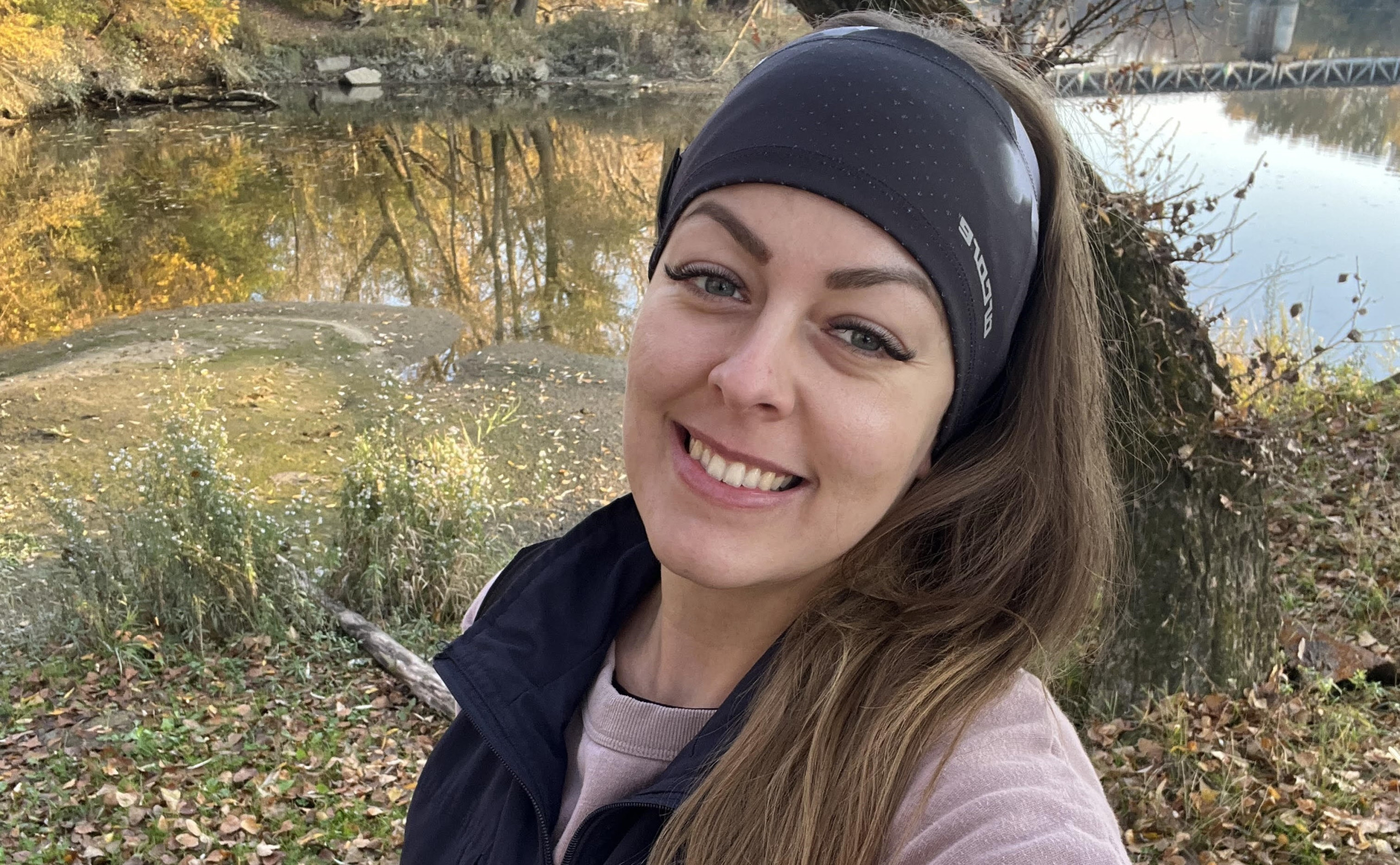 Ako 24-ročná dostala lupus: Na vypadávanie vlasov som nebola pripravená, ochorenie som poznala len z&nbsp;Doktora Housa