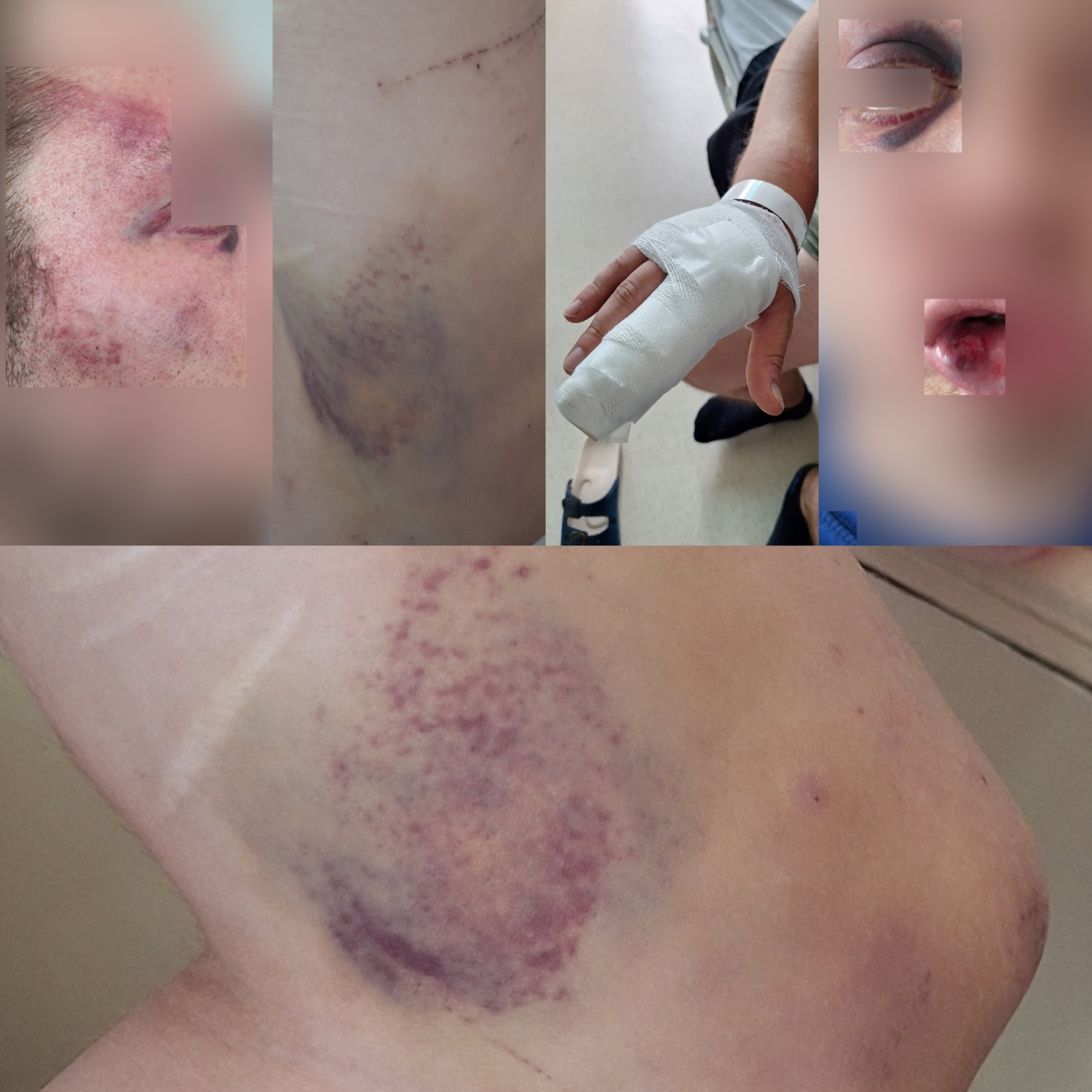 Ján požiadal políciu o&nbsp;pomoc, keď sa dostal na ulici do psychickej krízy. Policajt ho zbil, spomína