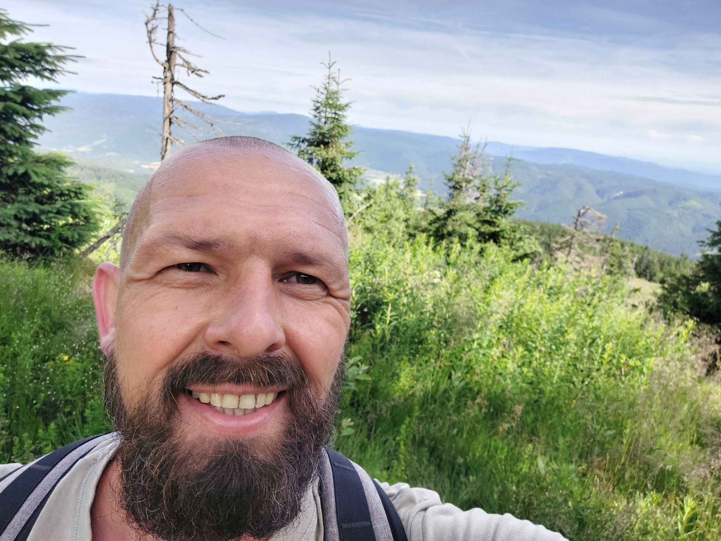 Dal som sa obrezať pre zdravotný problém. Nerozumiem, prečo to muži neriešia, vraví štyridsiatnik Matúš